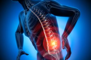 Back-Injury-Prevention-Training